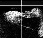 Volume Scan