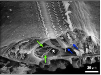 Inner and outer hair cells in the Organ of Corti.