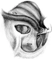 Diagram of a cochlea